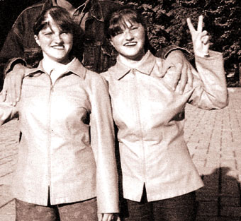 趣知廊.「<em>连体姊妹</em>」脑部分割长大成人 - 香港