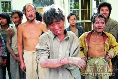 飽受折磨的黑窯工重見陽光,蓬頭垢面衣不遮體