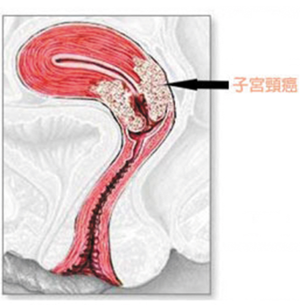 ���l�c�V���O�@��H���x�����k���g�C