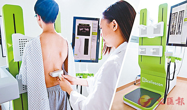 ■無輻射的脊柱側彎測量系統(Scolioscan)現已應用於多間診所及學校，為全球脊柱側彎患者帶來正面的影響。 理大圖片