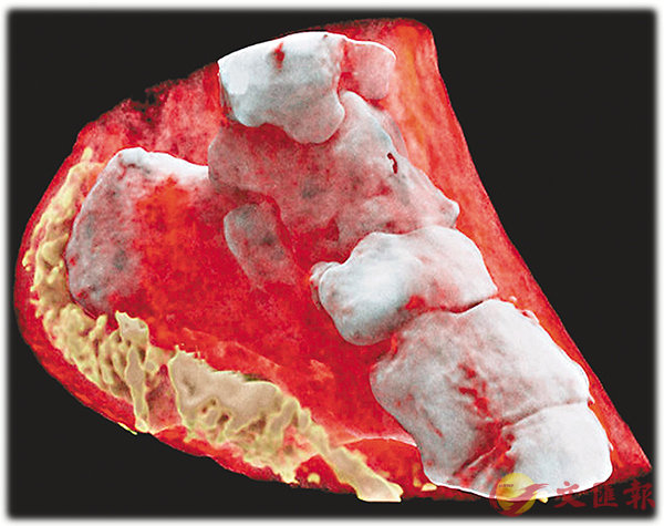 ���}��m����� X ���C  ���W�Ϥ�