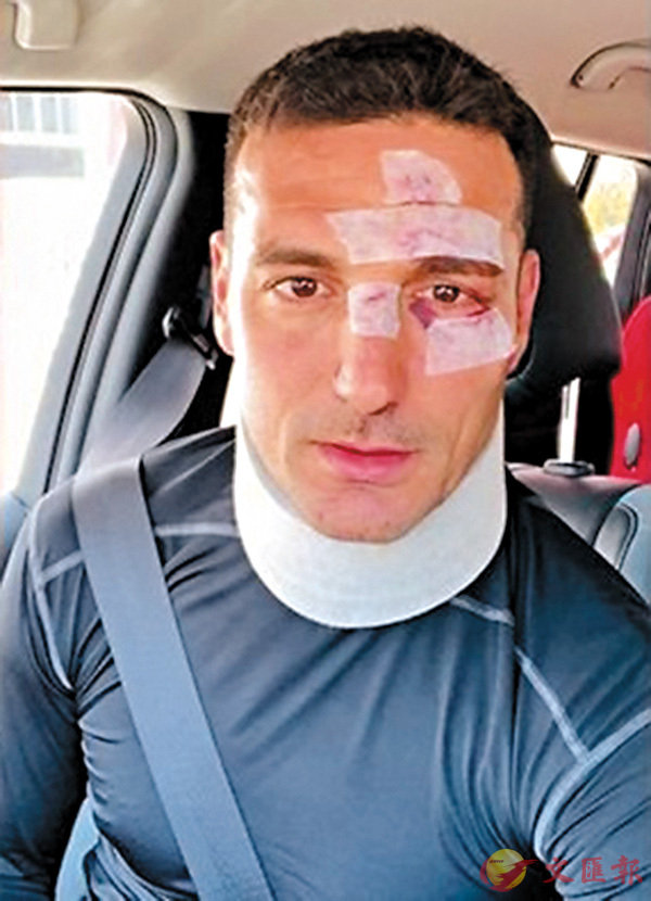 ���v�d�ԥ��������ˡC���W�Ϥ�