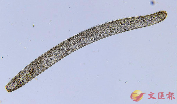 ■這種旋口蟲的學名是Spirostomum ambiguum，是一種單細胞的原生生物。 網上圖片