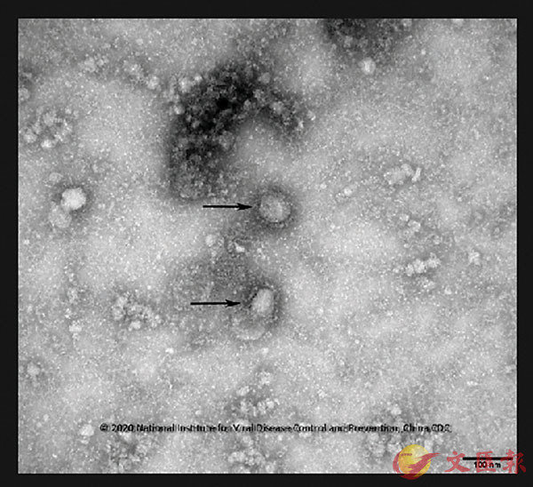 GISAID網站上載了一張由中國疾控中心提供的新型冠狀病毒在顯微鏡下的照片C