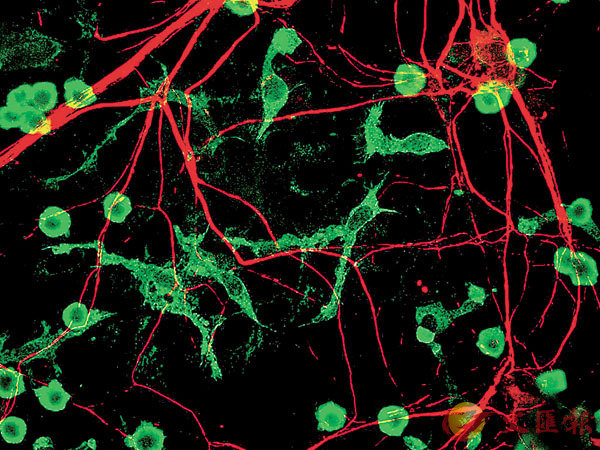 ■圖中綠色的是老鼠神經系統中的小膠質細胞（microglia）。 網上圖片